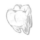 Bayshore's Gold Tooth